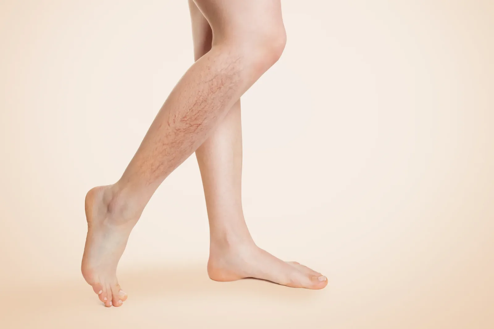 April Showers and Aching Legs: How Barometric Pressure