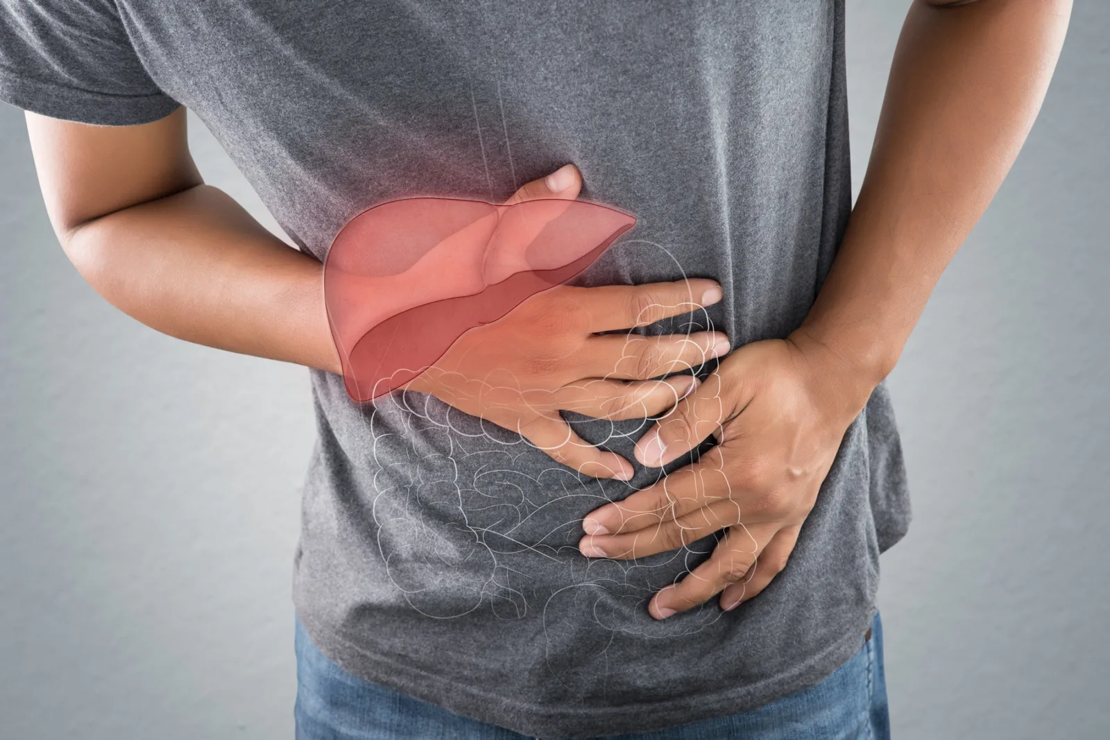 Are Spider Veins on the Rib Cage a Sign of Liver Disease?