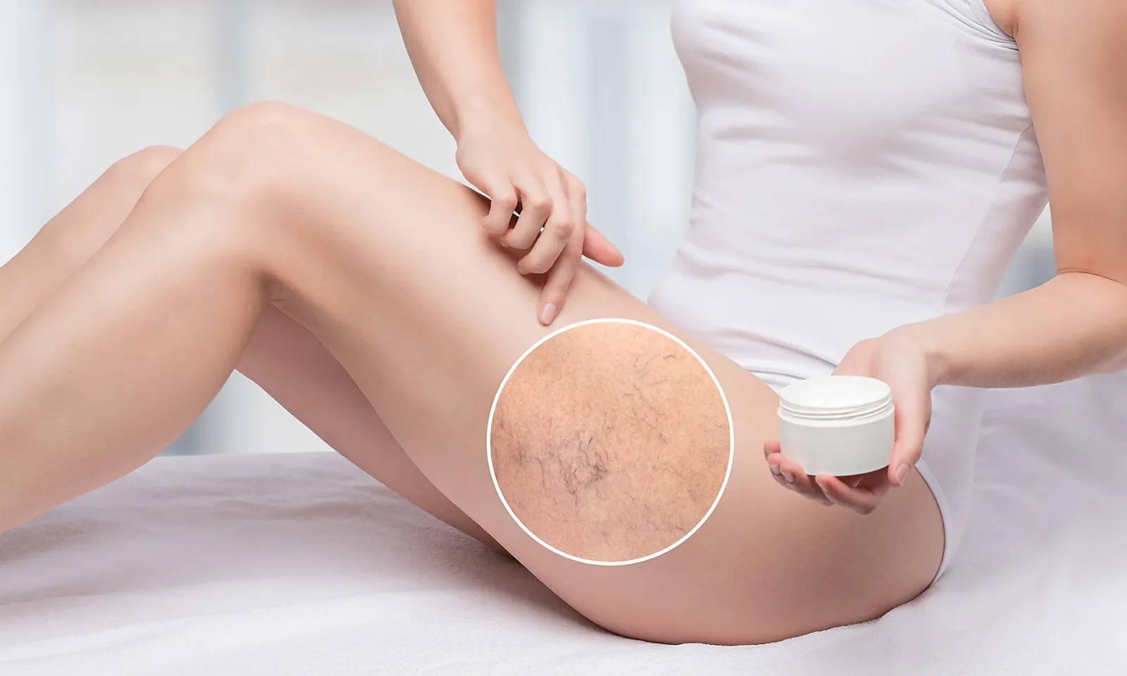What are the Different Treatments for Chronic Venous