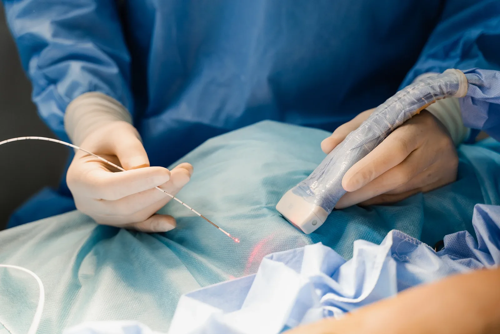 After a Spider Vein Laser Treatment, What Will My Legs Look