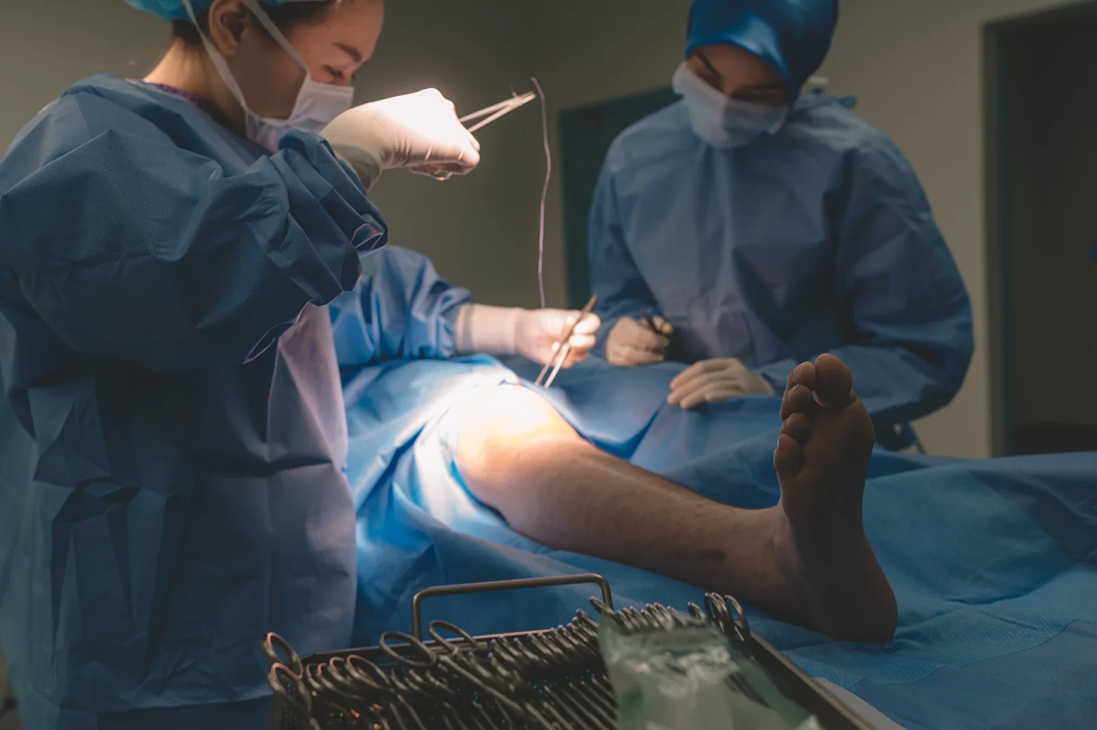 Will Having Varicose Vein Surgery Help With Circulation?